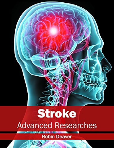 medical/neurology/stroke-advanced-researches-9781632413970