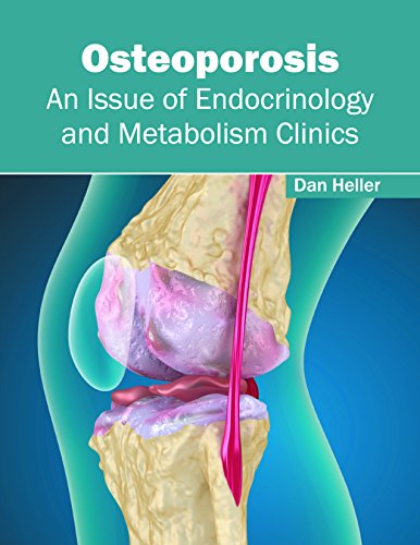 medical/orthopaedics/osteoporosis-an-issue-of-endocrinology-and-metabolism-clinics-9781632414199