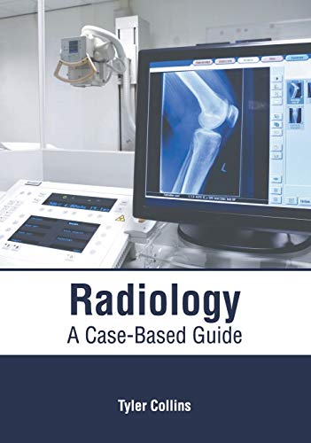 medical/radiology/radiology-a-case-based-guide-9781632415806