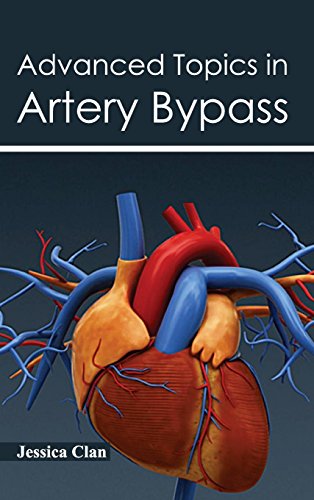 medical/cardiology/advanced-topics-in-artery-bypass-9781632420299
