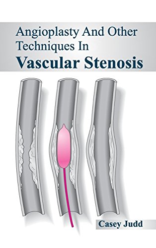 medical/cardiac-surgery/angioplasty-and-other-techniques-in-vascular-stenosis-9781632420480