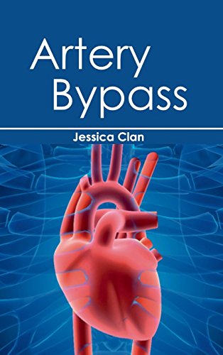 medical/cardiac-surgery/artery-bypass-9781632420541