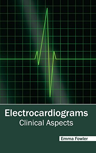 medical/cardiology/electrocardiograms-clinical-aspects-9781632421227