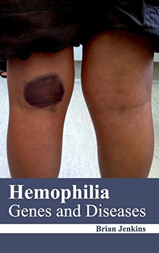 medical/general-medicine/hemophilia-genes-and-diseases-9781632422279