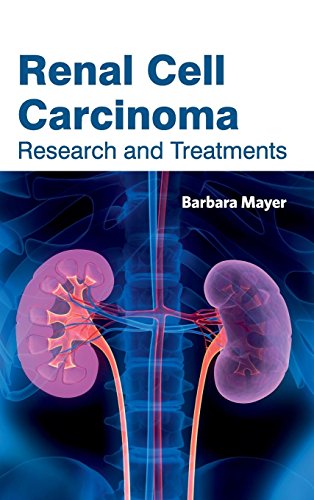 medical/gastroenterology/renal-cell-carcinoma-research-and-treatments-9781632423566