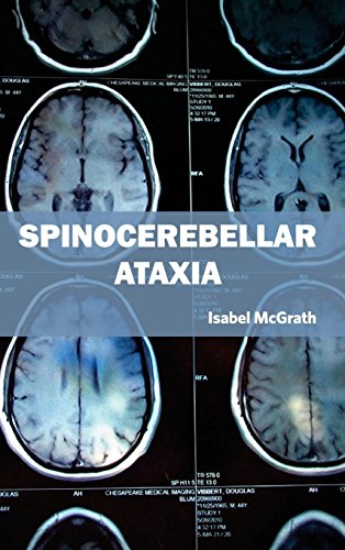 medical/neurology/spinocerebellar-ataxia-9781632423788