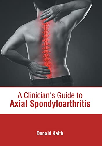 A CLINICIAN'S GUIDE TO AXIAL SPONDYLOARTHRITIS