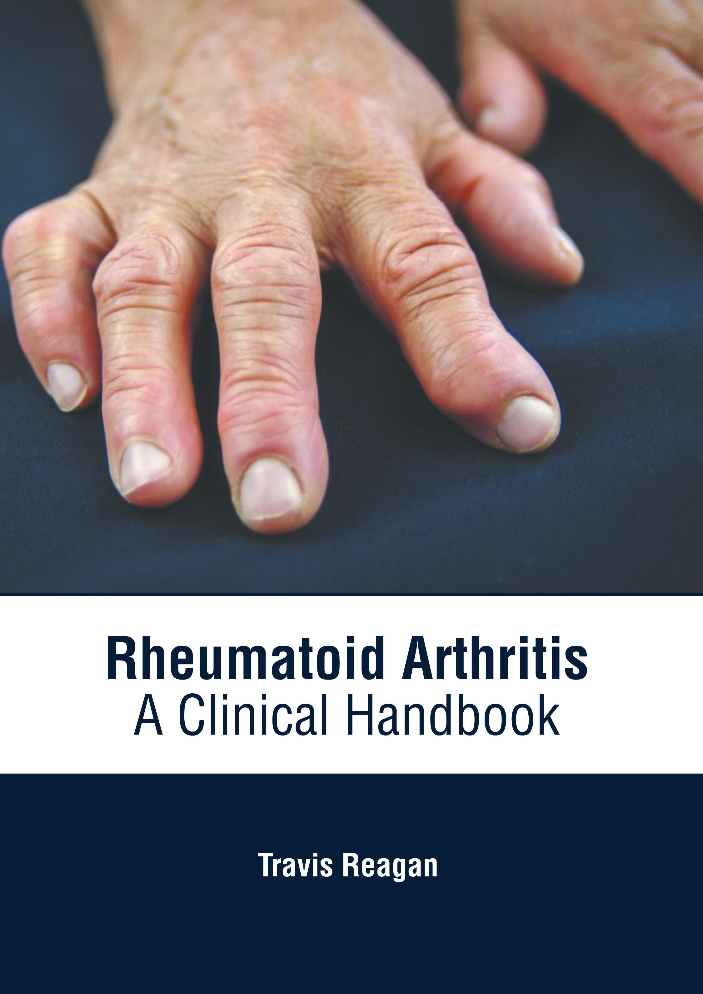 exclusive/orthopaedics/rheumatoid-arthritis-a-clinical-handbook-9781639274758