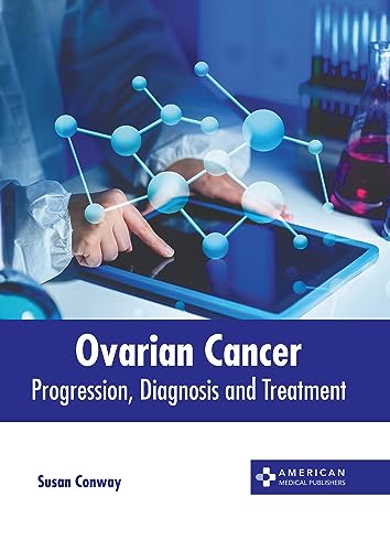 OVARIAN CANCER: PROGRESSION, DIAGNOSIS AND TREATMENT