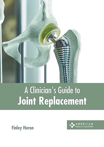 A CLINICIAN'S GUIDE TO JOINT REPLACEMENT