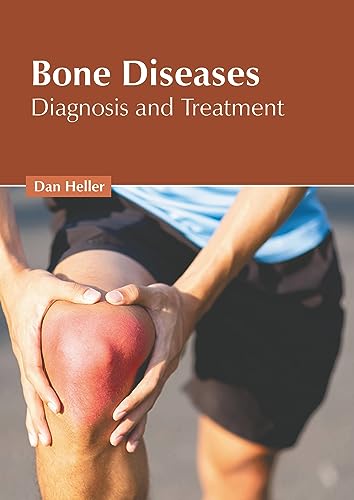 BONE DISEASES: DIAGNOSIS AND TREATMENT