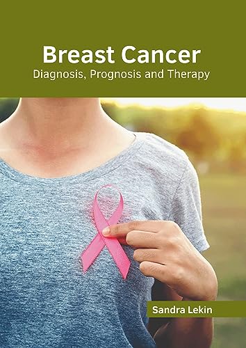 exclusive/oncology/breast-cancer-diagnosis-prognosis-and-therapy-9781639279470