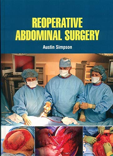 REOPERATIVE ABDOMINAL SURGERY medical/general-surgery/reoperative-abdominal-surgery-9781644351208