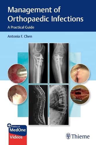 MANAGEMENT OF ORTHOPAEDIC INFECTIONS A PRACTICAL GUIDE medical/orthopaedics/management-of-orthopaedic-infections-a-practical-guide-9781684201334