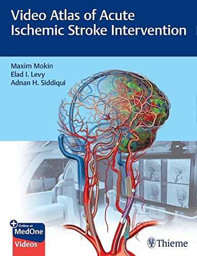 medical-reference-books//video-atlas-of-acute-ischemic-stroke-intervention-1st-ed--9781684202492