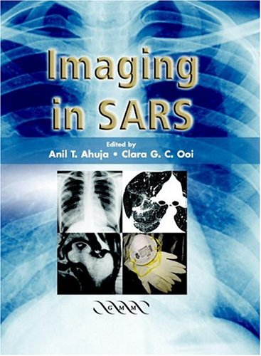IMAGING IN SARS (EXCL. ABC)