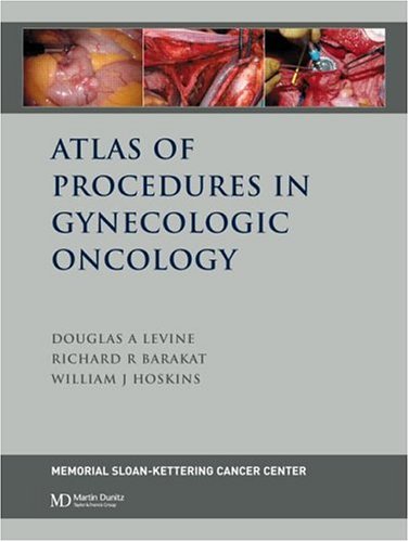 medical//atlas-of-procedures-in-gynecologic-oncology-9781841841960