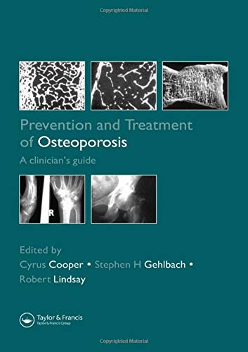 medical/orthopaedics/prevention-and-treatment-of-osteporosis-9781841842837