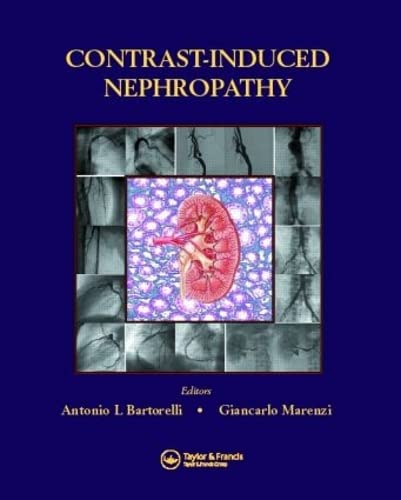 medical/cardiac-surgery/contrast-induced-nephropathy-in-interventional-cardiovascular-medicine-9781841845623