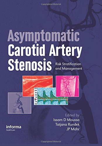 medical/cardiology/asymptomatic-caritid-artery-stenosis-9781841846132