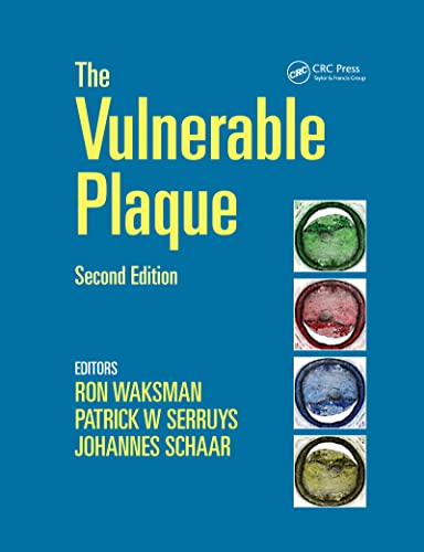 medical/cardiology/the-vulnerable-plaque-2ed-9781841846217