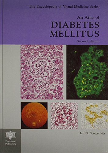 medical/endocrinology/an-atlas-of-diabetes-mellitus-9781842140093