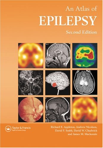 medical/neurology/atlas-of-epilepsy-2ed-9781842140277