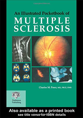 medical/neurology/an-illustrated-pocketbook-of-multiple-sclerosis-9781842141410