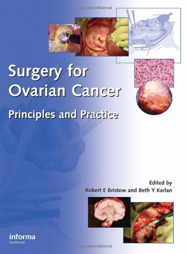 medical//surgery-for-ovsarian-cancer-priciples-and-practice-9781842141656
