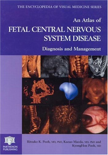 medical/neurology/an-atlas-of-fetal-central-nervous-system-disease-9781842142028