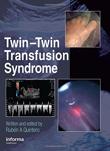 medical//twin-twin-transfusion-syndrome-9781842142981