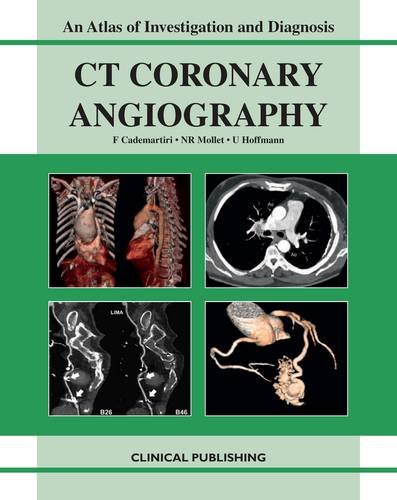 medical/cardiology/ct-coronary-angiography-an-atlas-of-investigation-and-diagnosis-9781846920103