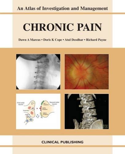 technical/general/chronic-pain-an-atlas-of-investigation-and-management-9781846920332