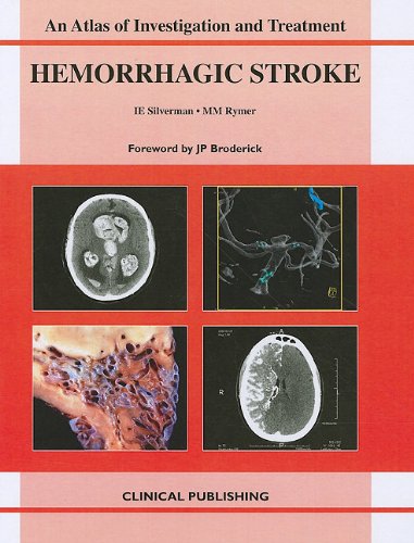 medical/neurology/an-atlas-of-investigation-and-treatment-hemorrhagic-stroke-9781846920394