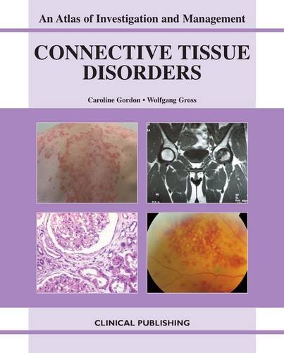 medical/general-medicine/connective-tissue-diseases-atlas-of-investigation-and-management-9781846920745