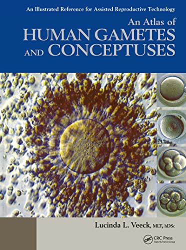 medical//an-atlas-of-human-gametes-and-conceptuses-an-illustrated-reference-for-assisted-reproductive-technology-9781850700166