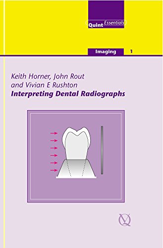 medical/dentistry/interpreting-dental-radiographs-quint-essentials-imaging-9781850970521