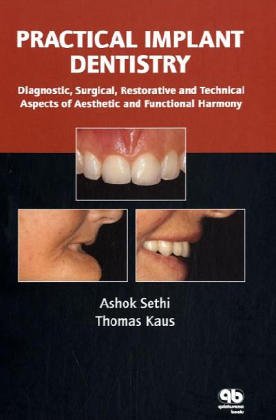 medical/dentistry/practical-implant-dentistry-9781850970613