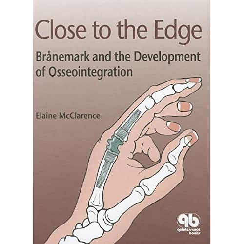 technical//close-to-the-edge-branemark-and-the-development-of-osseointegration-9781850970675