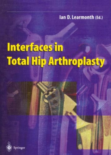 technical/general/interfaces-in-total-hip-arthroplasty-9781852332051