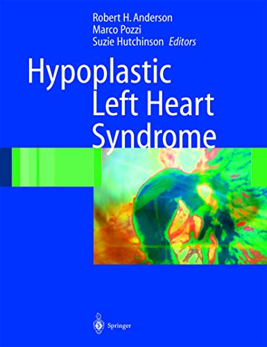 medical/cardiology/hypoplastic-left-heart-syndrome-9781852337650