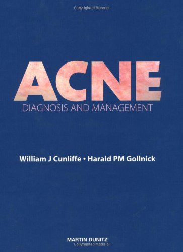 medical/physiotherapy/acne-diagnosis-and-management-9781853172069
