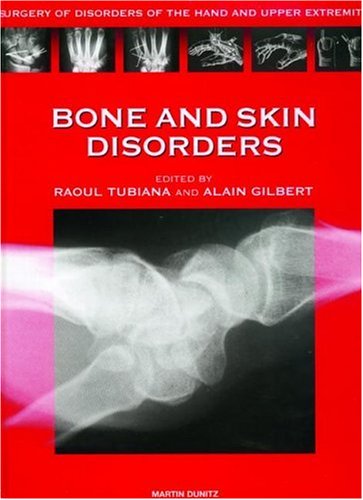 medical/surgery/bone-and-skin-disorders-surgery-of-disorders-of-the-hand-and-upper-extremity-surgery-of-disorders-of-the-hand-and-upper-extremity-series--9781853174933