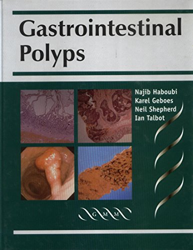 GASTROINTESINAL POYPS