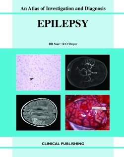 medical/neurology/epilepsy-an-atlas-of-investigation-and-management-9781904392545