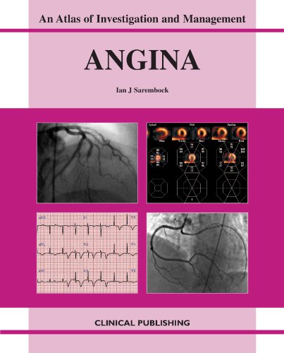 medical/cardiology/an-atlas-of-investigation-and-management-angina-9781904392590
