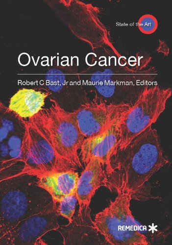 medical//ovarian-cancer-9781905721535