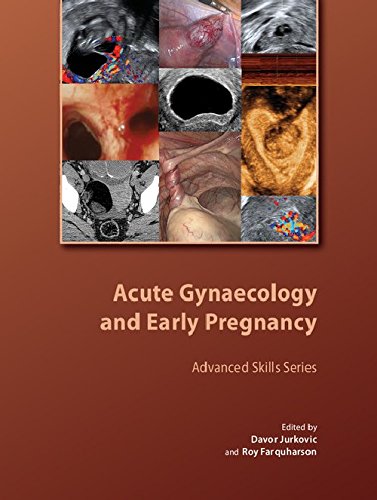 medical//acute-gynaecology-and-early-pregnancy-9781906985325