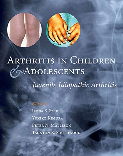 medical/orthopaedics/arthritis-in-children-adolescents-9780192632920