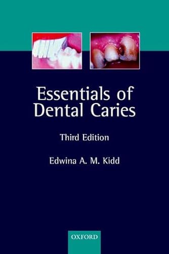 medical/dentistry/essentials-of-dental-caries-the-disease-and-its-management-3rd-ed-9780198529781